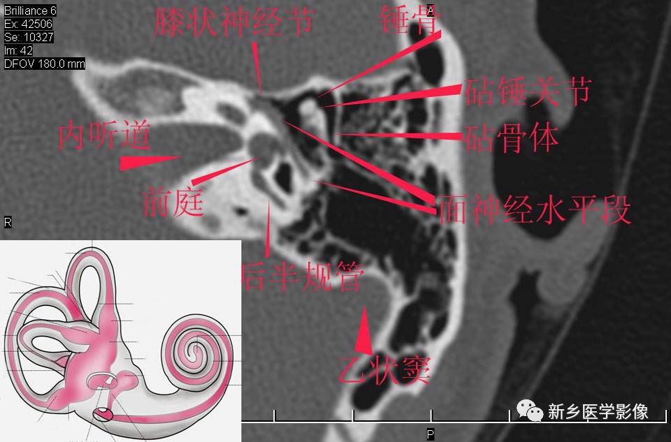 耳部详细解剖纯手工标注