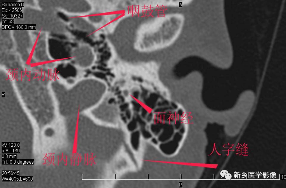 耳部详细解剖纯手工标注