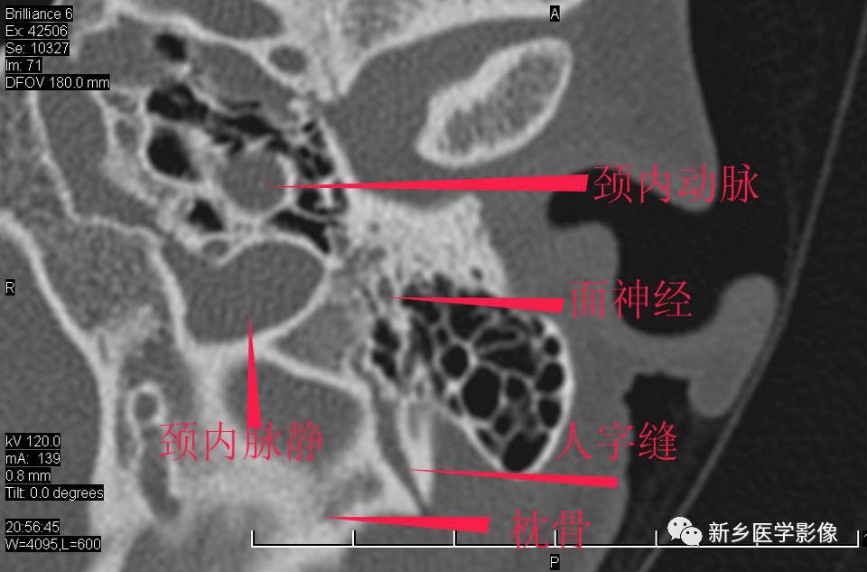 耳部详细解剖纯手工标注