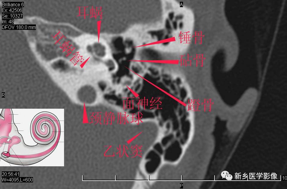 耳部详细解剖纯手工标注