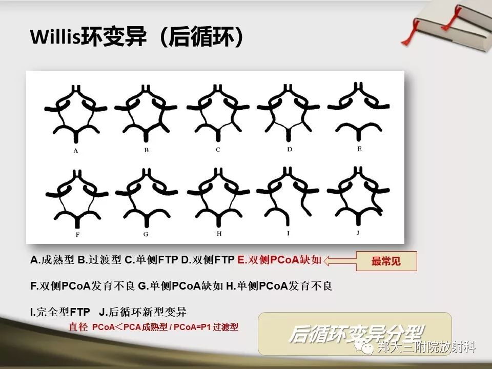 【PPT】头颈联合CTA临床应用