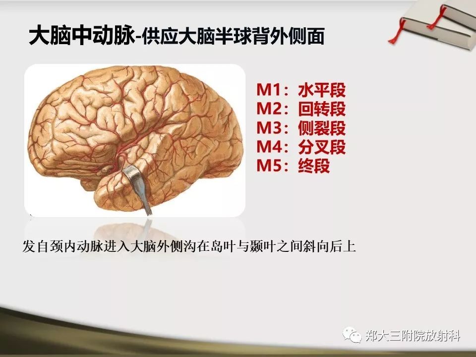 【PPT】头颈联合CTA临床应用