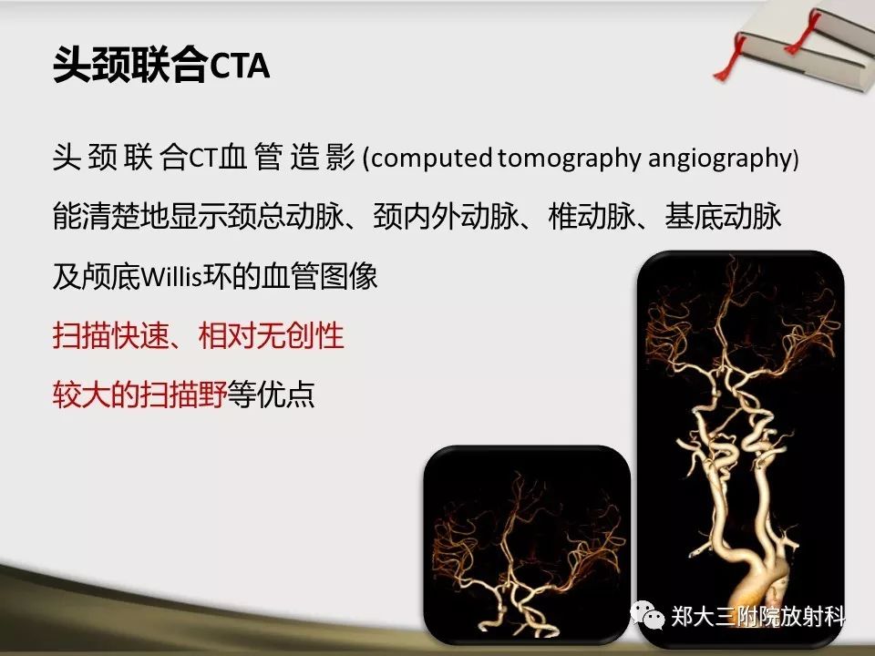 【PPT】头颈联合CTA临床应用