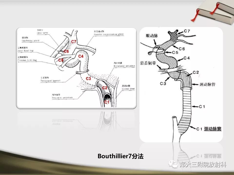 【PPT】头颈联合CTA临床应用