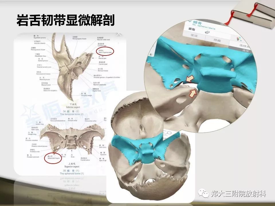 【PPT】头颈联合CTA临床应用