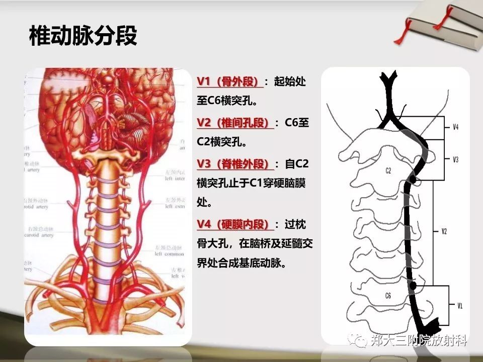 【PPT】头颈联合CTA临床应用