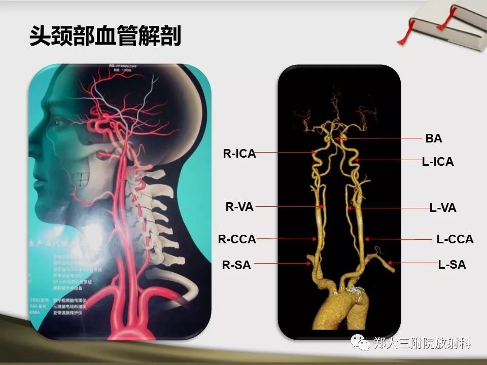 【PPT】头颈联合CTA临床应用