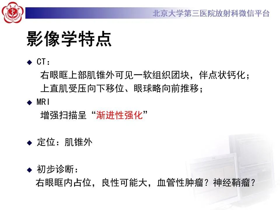 【PPT】眶内海绵状血管瘤