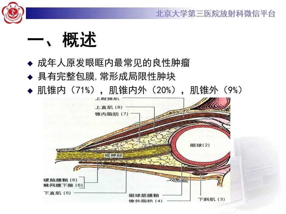 【PPT】眶内海绵状血管瘤