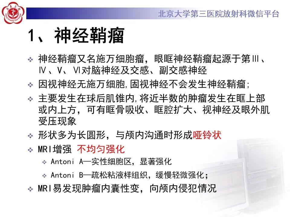 【PPT】眶内海绵状血管瘤