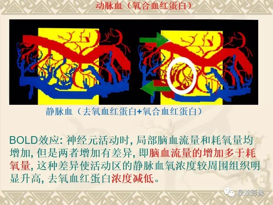 【PPT】SWI（磁敏感加权成像）在中枢神经系统疾病的应用