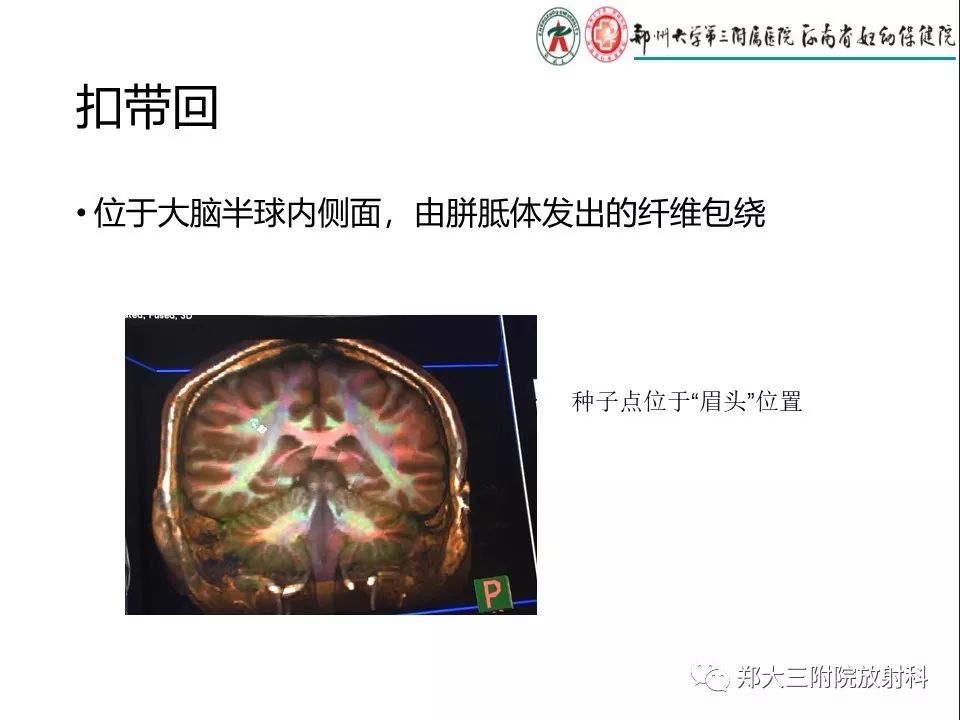 【PPT】DTI常规处理