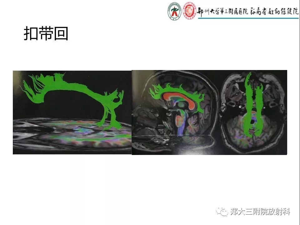 【PPT】DTI常规处理