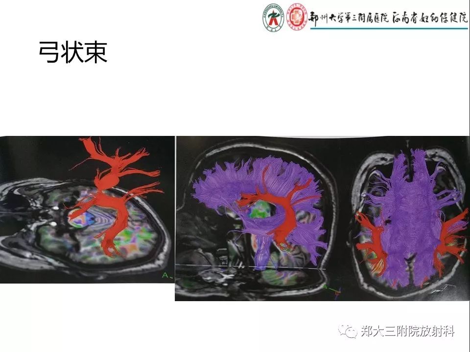 【PPT】DTI常规处理