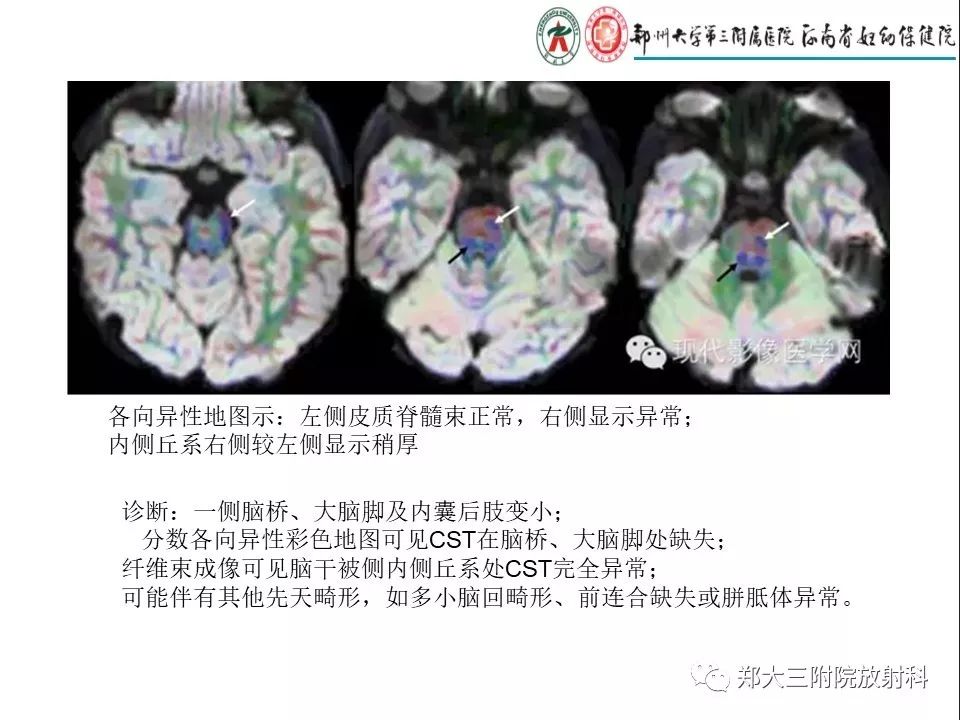 【PPT】DTI常规处理