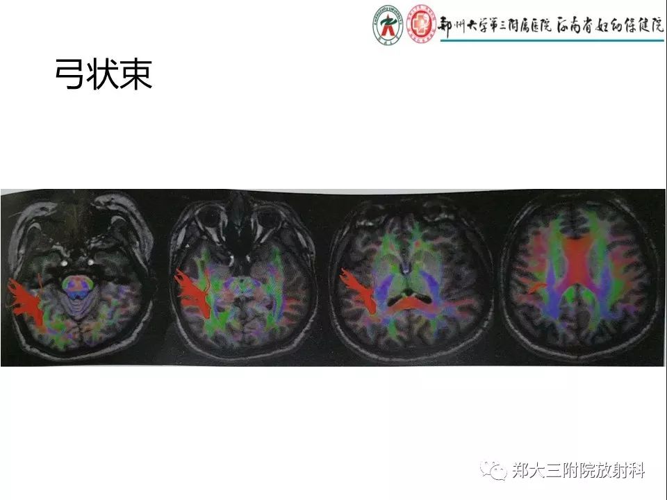 【PPT】DTI常规处理