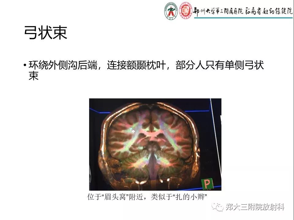 【PPT】DTI常规处理