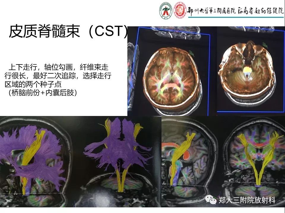 【PPT】DTI常规处理