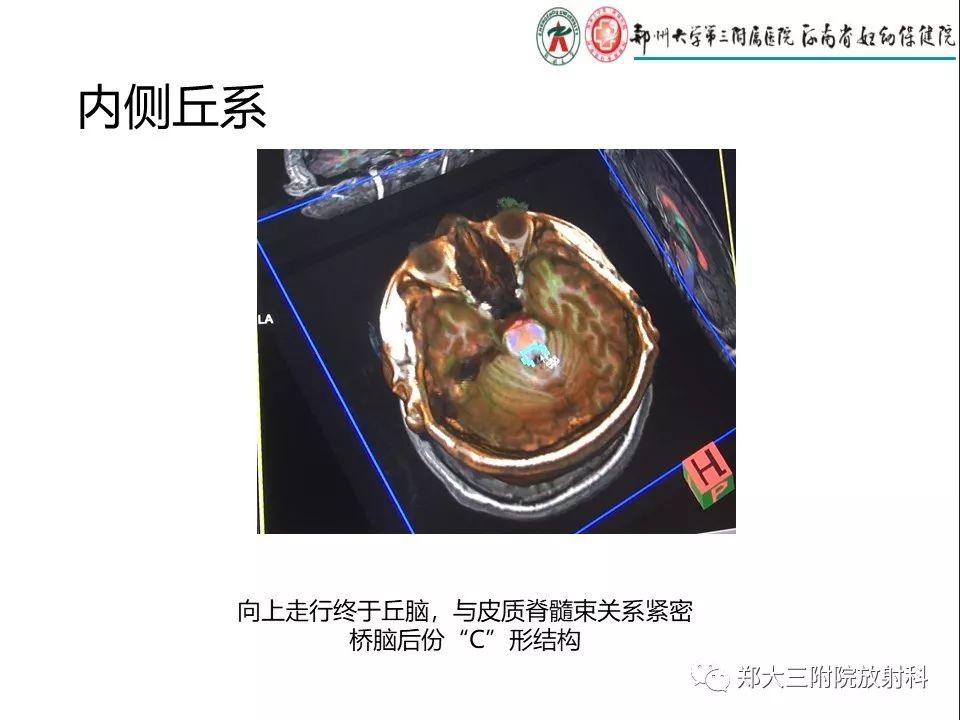 【PPT】DTI常规处理