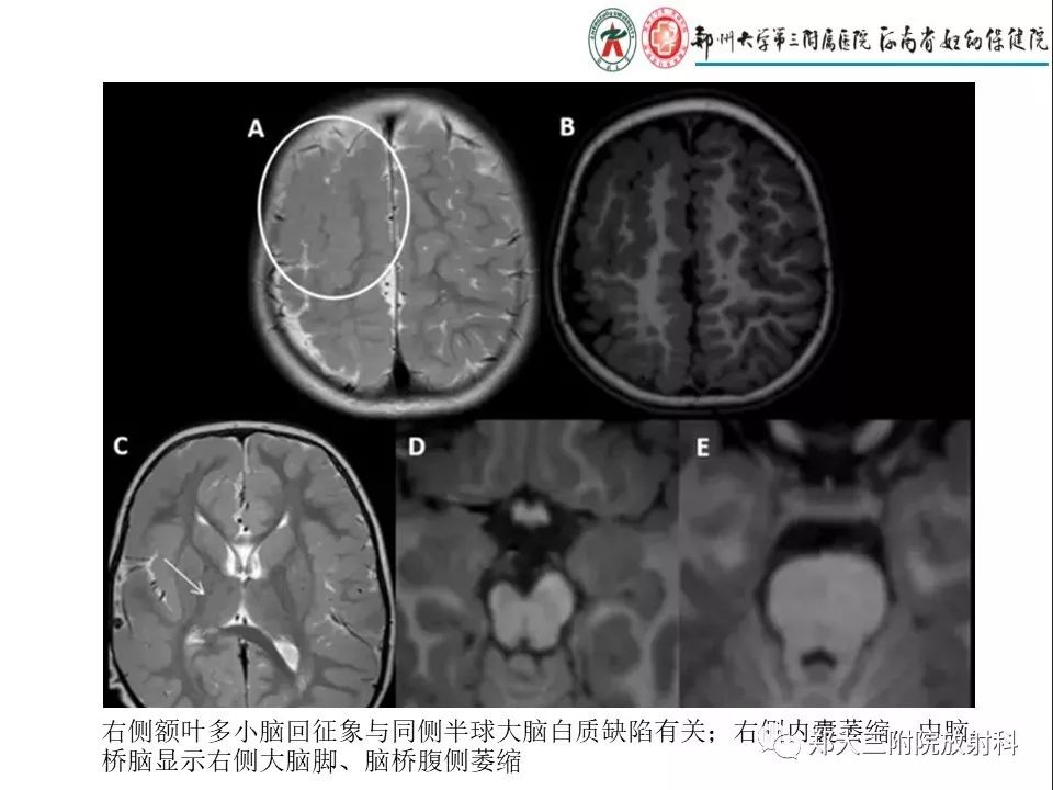 【PPT】DTI常规处理