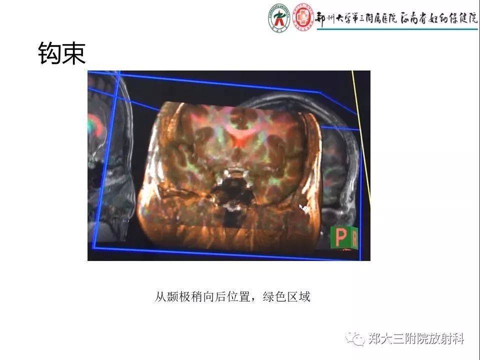 【PPT】DTI常规处理