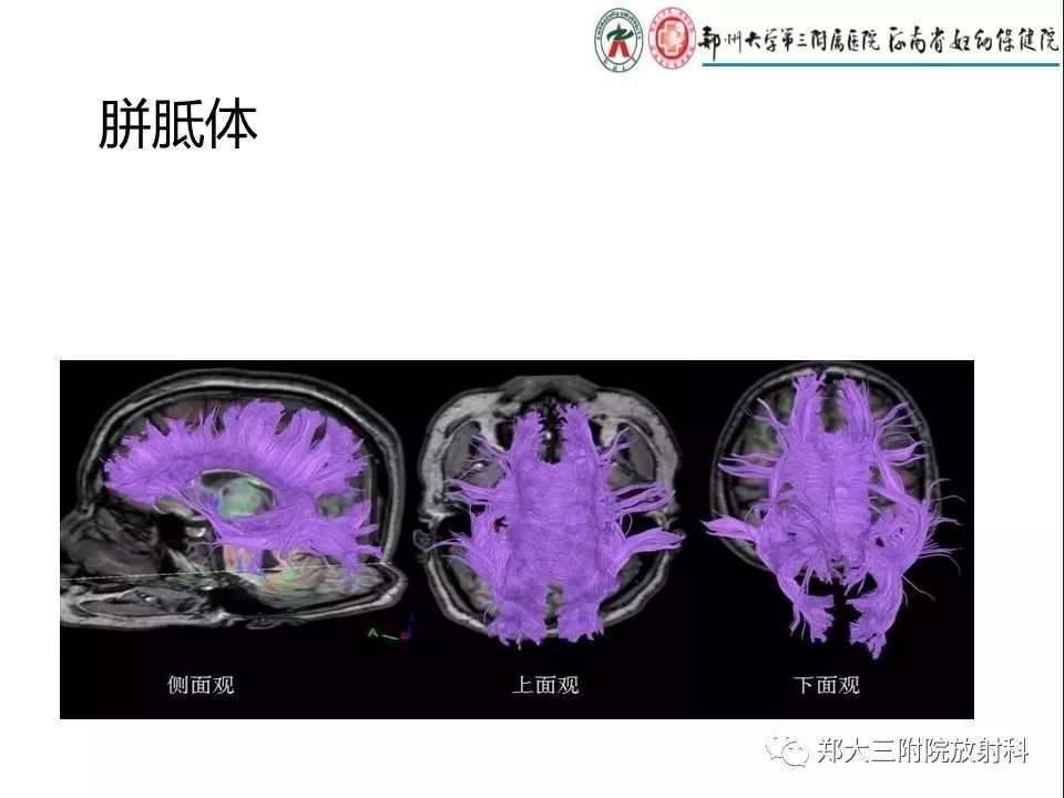 【PPT】DTI常规处理