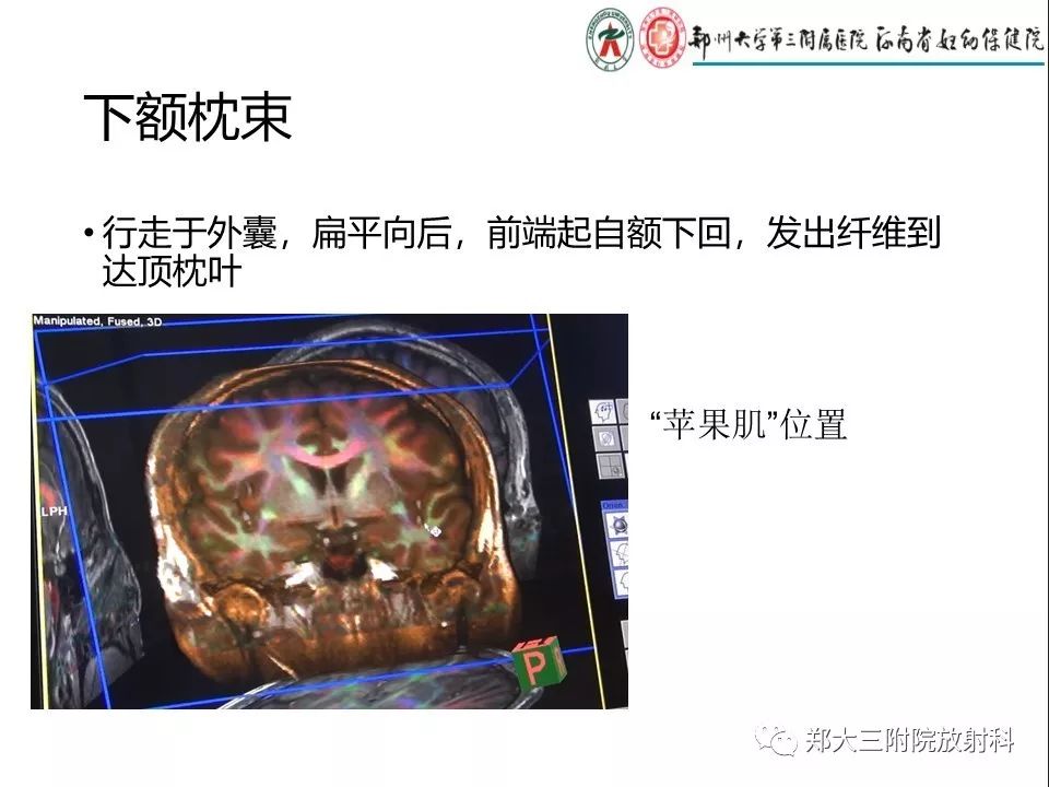 【PPT】DTI常规处理