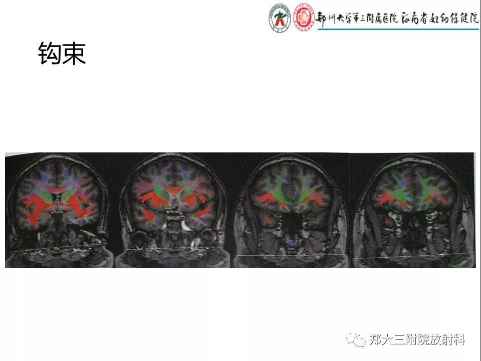 【PPT】DTI常规处理