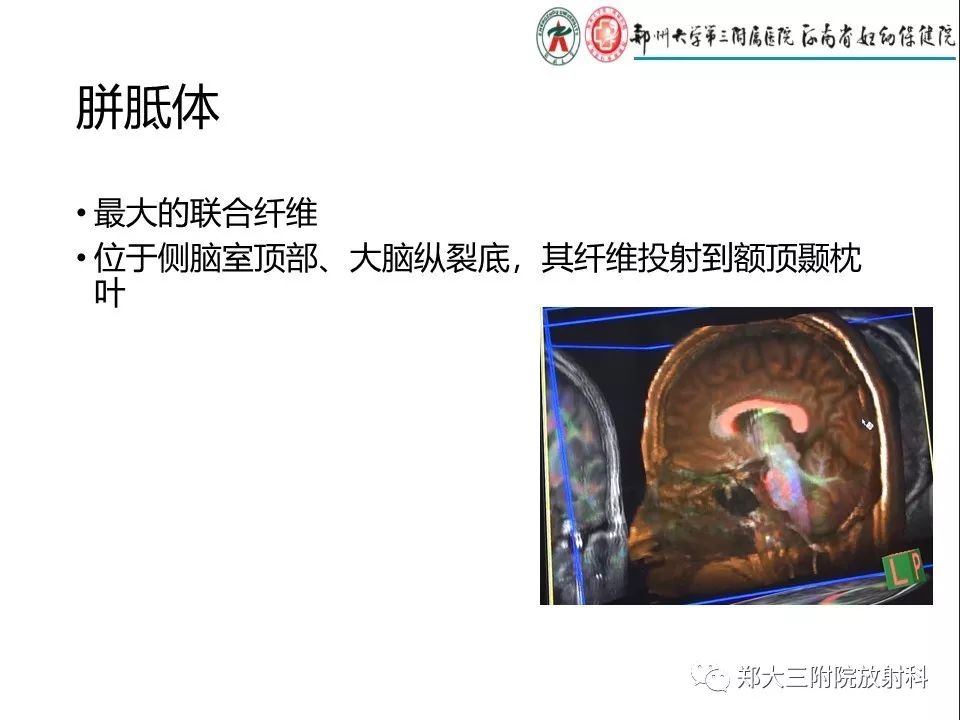 【PPT】DTI常规处理