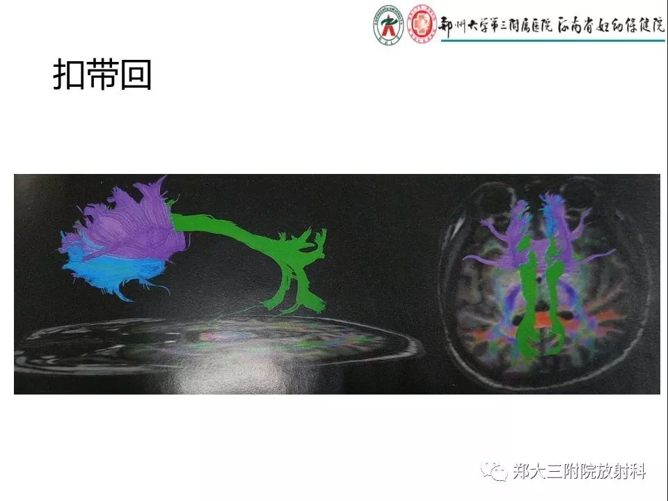 【PPT】DTI常规处理