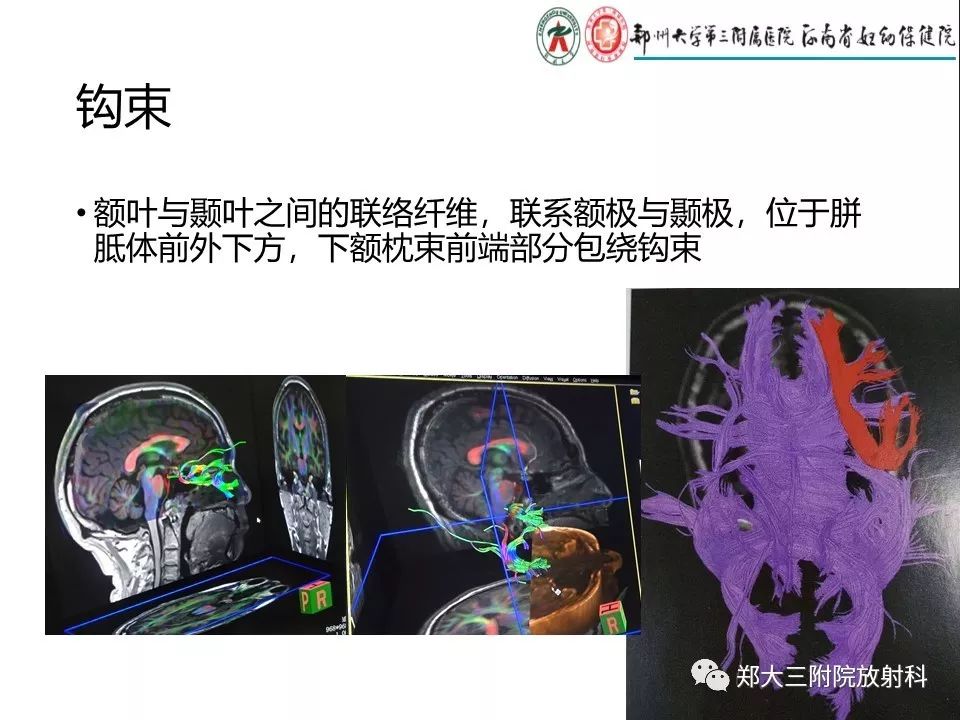 【PPT】DTI常规处理