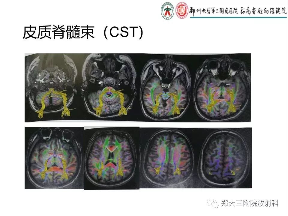 【PPT】DTI常规处理