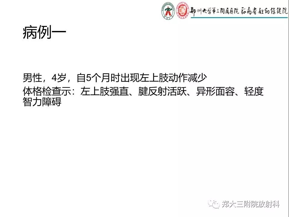 【PPT】DTI常规处理