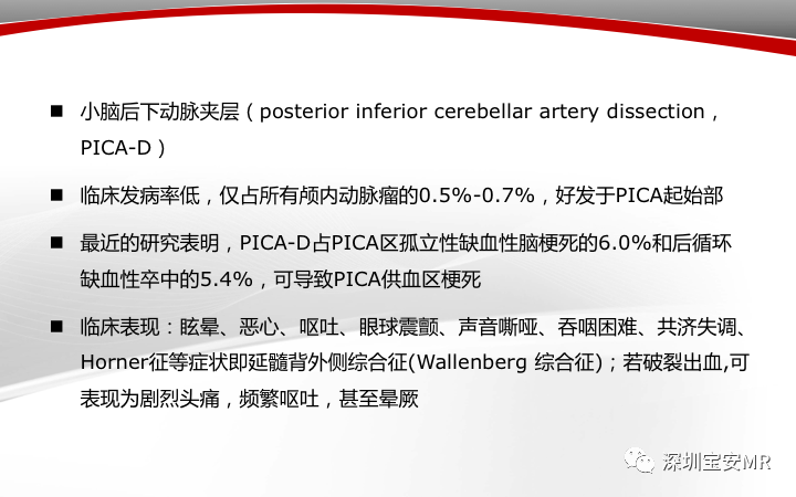 【病例】小脑后下动脉夹层1例MR