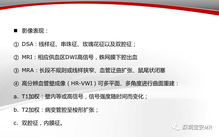 【病例】小脑后下动脉夹层1例MR