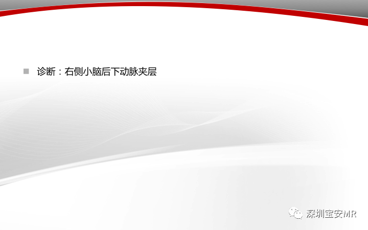 【病例】小脑后下动脉夹层1例MR