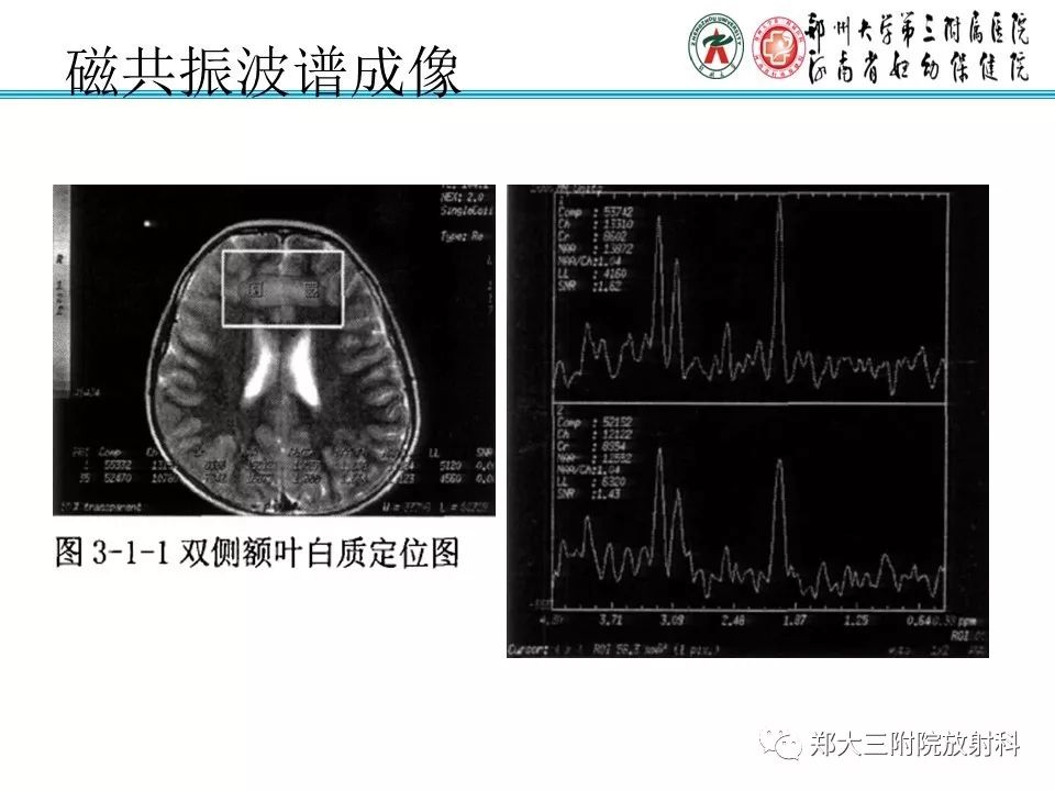【PPT】MRI在孤独症诊疗中的应用价值
