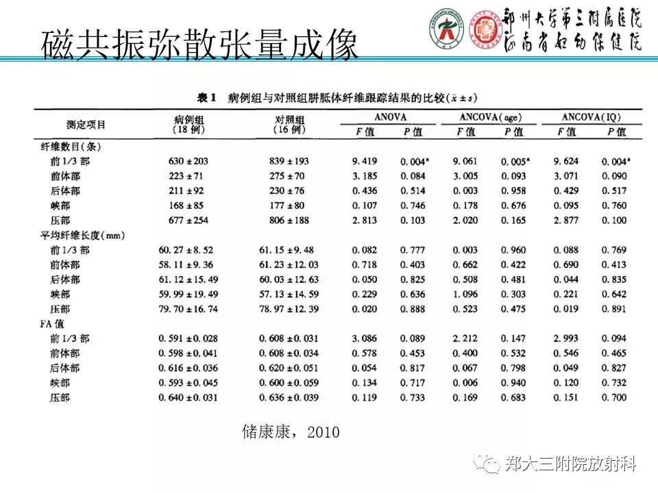 【PPT】MRI在孤独症诊疗中的应用价值
