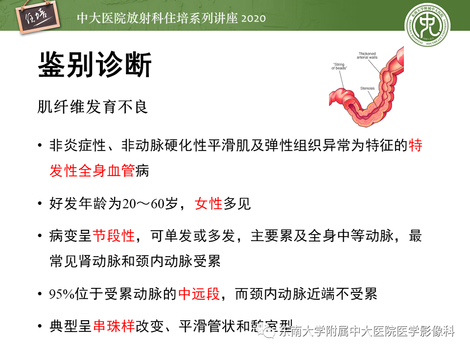 【PPT】颈动脉夹层及夹层动脉瘤的影像诊断及评估