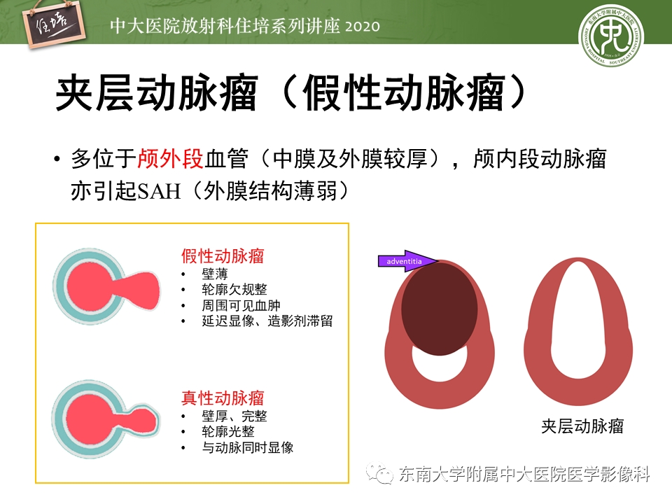 【PPT】颈动脉夹层及夹层动脉瘤的影像诊断及评估