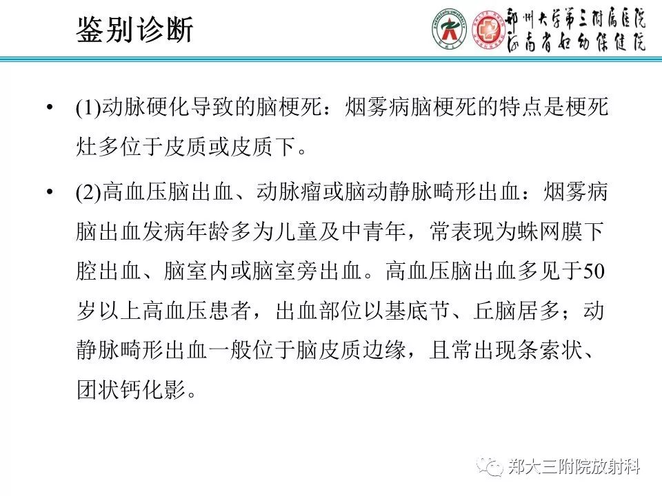 【PPT】烟雾病的影像诊断