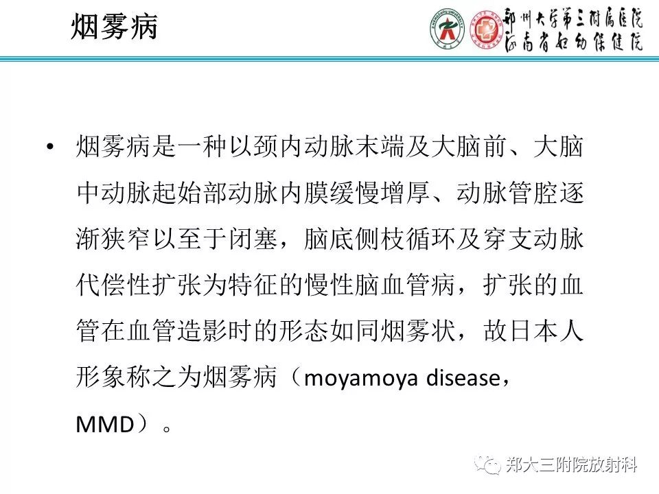 【PPT】烟雾病的影像诊断