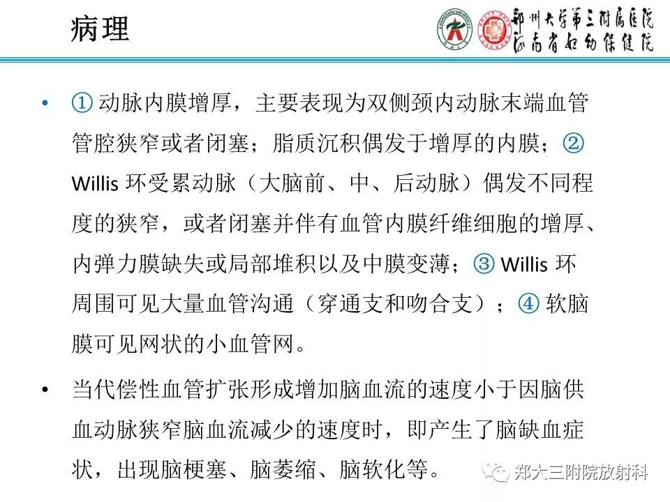 【PPT】烟雾病的影像诊断