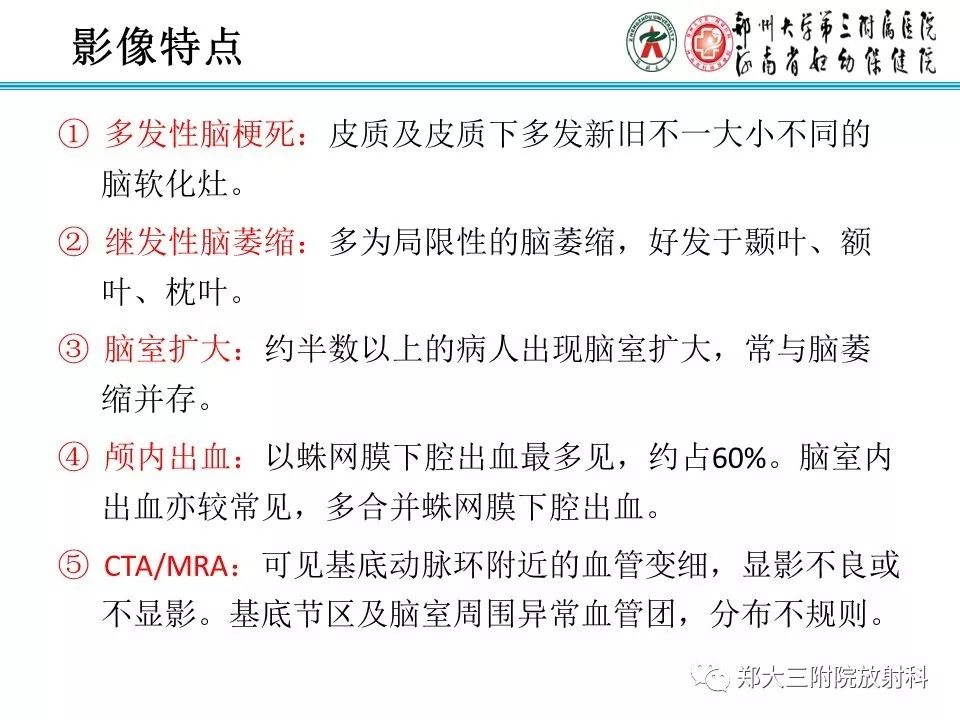 【PPT】烟雾病的影像诊断