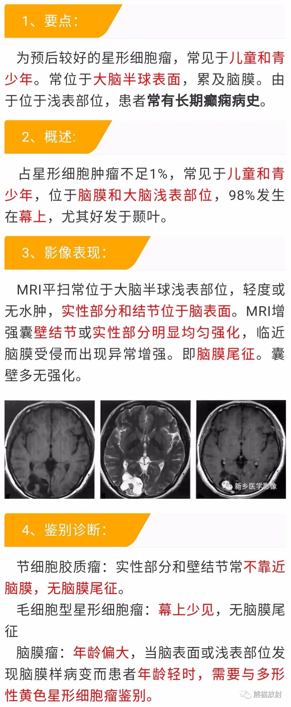 【病例】多形性黄色星形细胞瘤1例MR影像