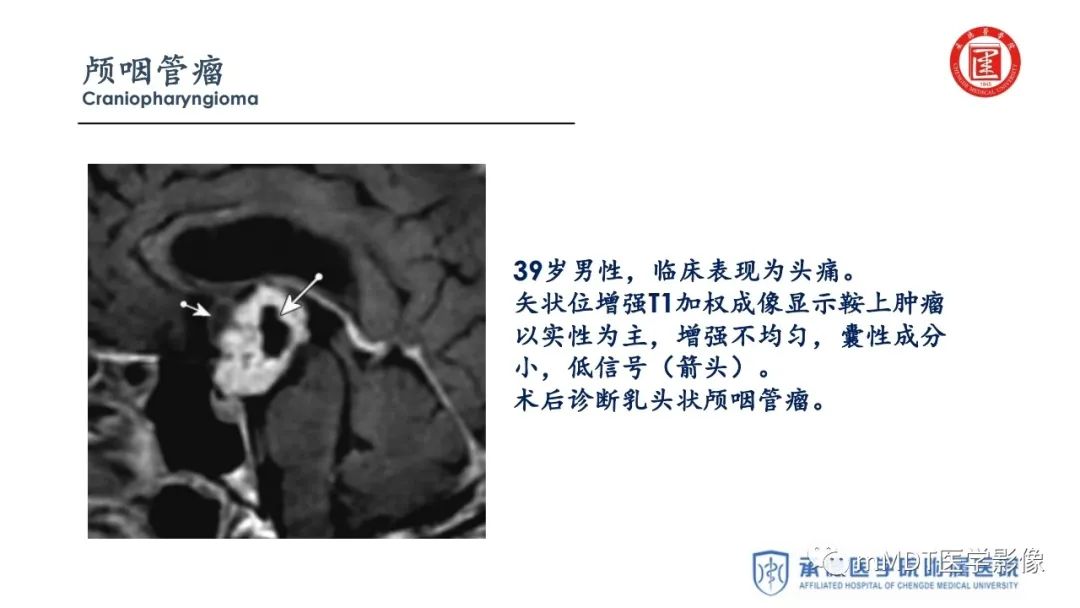 【PPT】下丘脑疾病的磁共振诊断