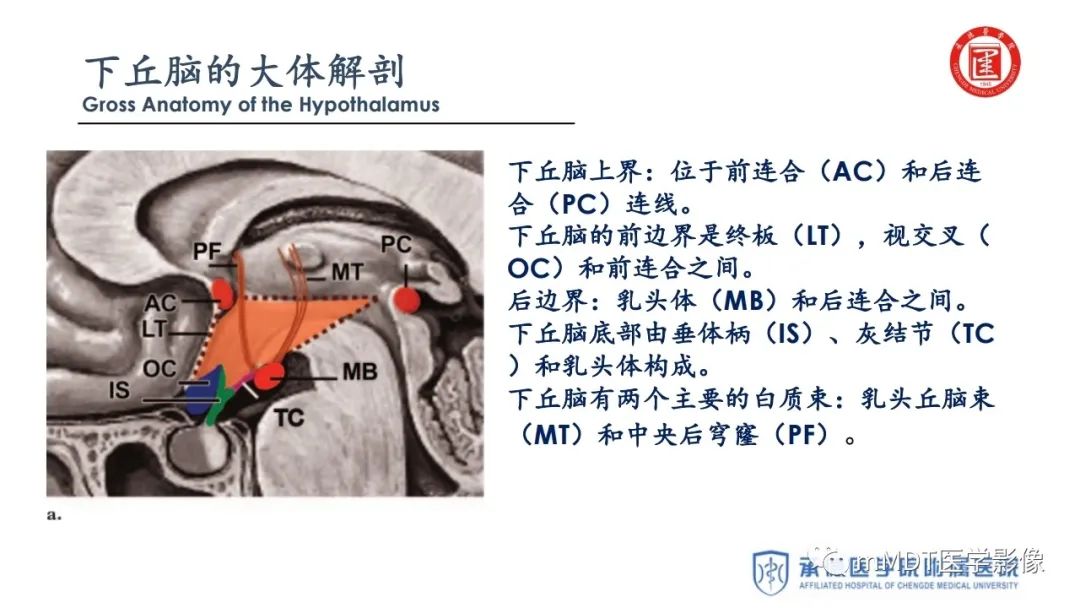 【PPT】下丘脑疾病的磁共振诊断