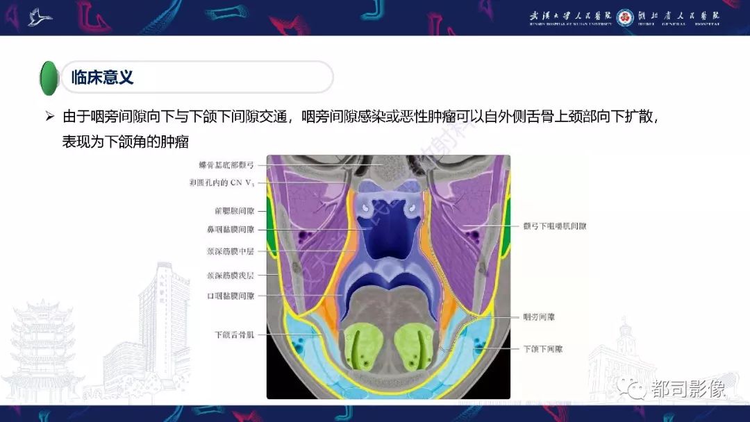 【PPT】咽旁间隙解剖及病变影像诊断