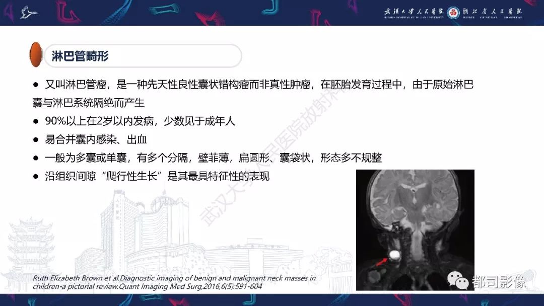 【PPT】咽旁间隙解剖及病变影像诊断