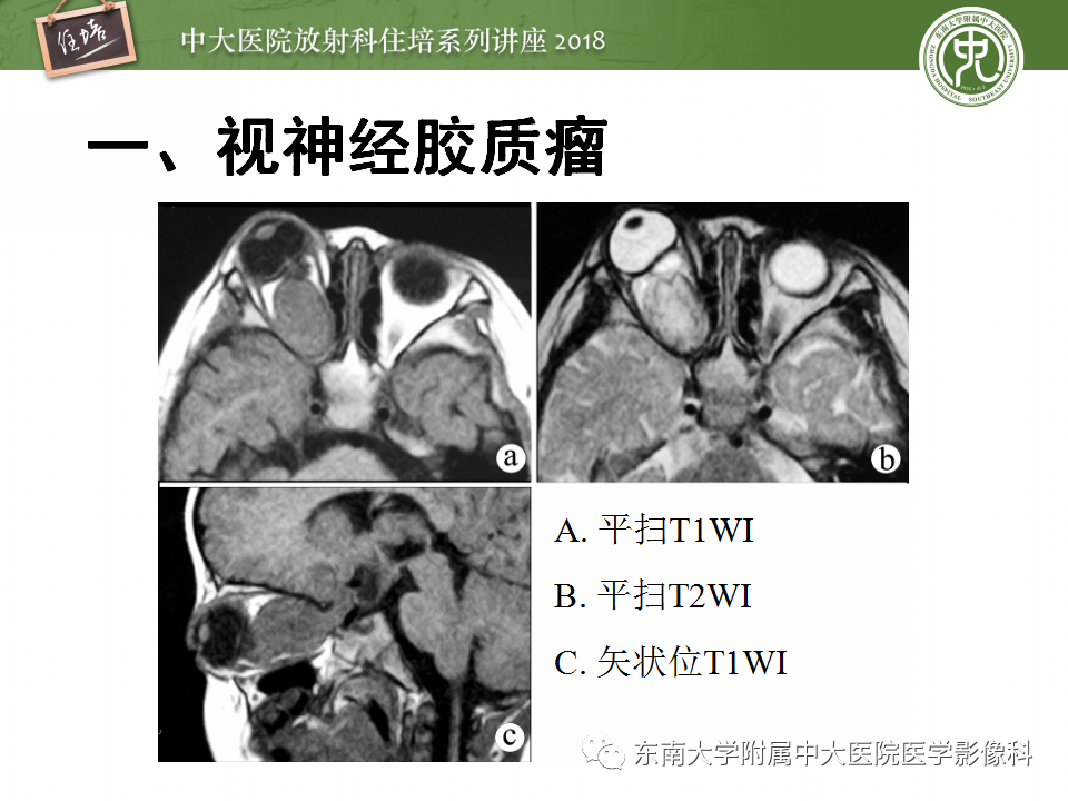 【PPT】眼眶内占位性病变的影像诊断